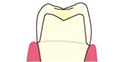 歯の治療メニュー