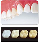 歯の治療メニュー